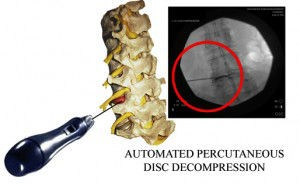 autodisc2